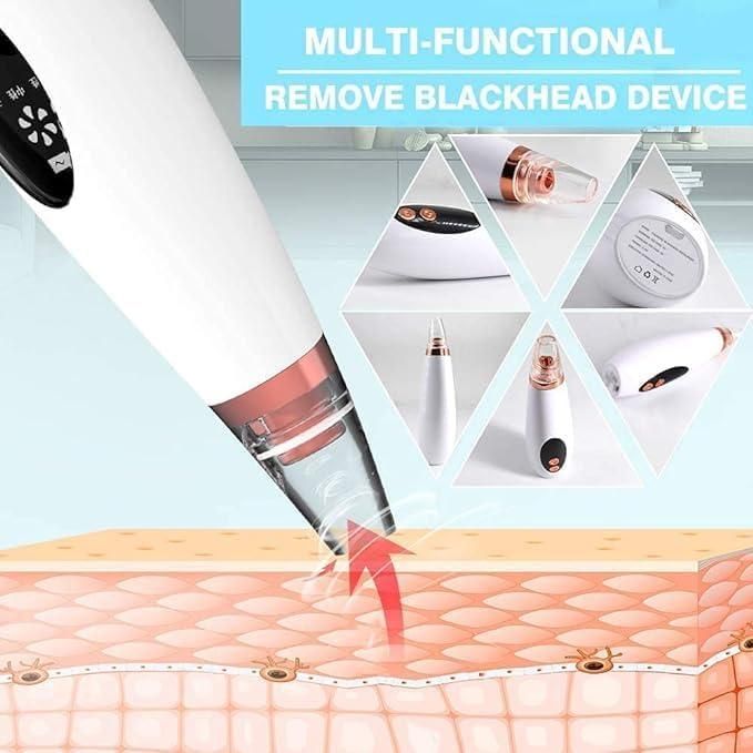 6-in-1 Multi-Function Blackhead Remover Tool