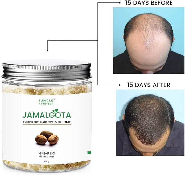 JamalGota Ayurvedic Hair Grwoth Tonic