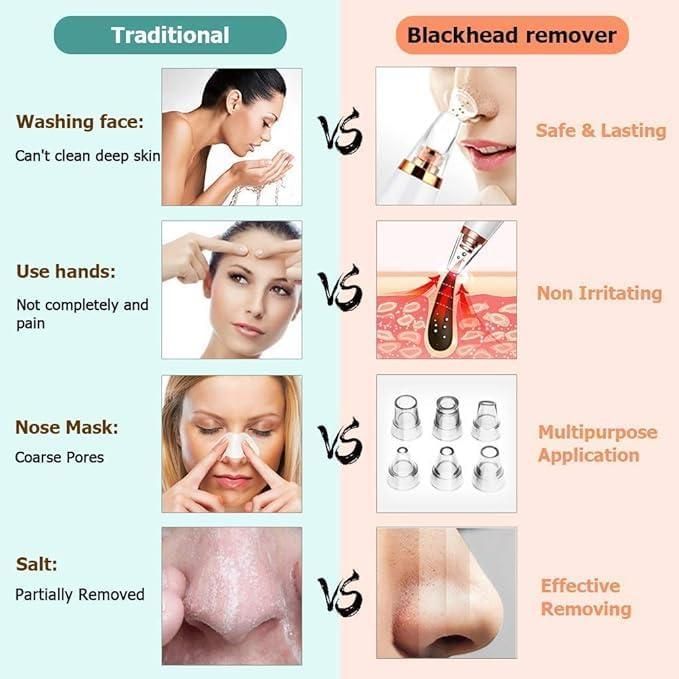 6-in-1 Multi-Function Blackhead Remover Tool